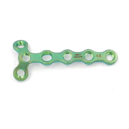 Nẹp Khóa Nén Ép Tái Tạo Chữ Y 2.0mm (Titanium) Nẹp Khóa Nén Ép Tái Tạo Chữ Y 2.0mm (Titanium)