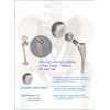 Bộ Khớp Háng Nhân Tạo Sinh Học (Biological Hip Joint Set - Không xi măng) Bộ Khớp Háng Nhân Tạo Sinh Học (Biological Hip Joint Set - Không xi măng)