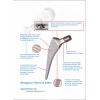 Bộ Khớp Háng Nhân Tạo Sinh Học (Biological Hip Joint Set - Không xi măng) Bộ Khớp Háng Nhân Tạo Sinh Học (Biological Hip Joint Set - Không xi măng)