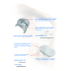 Bộ Khớp Gối Nhân Tạo (Knee Joint Prosthesis Set - Loại có xi măng) Bộ Khớp Gối Nhân Tạo (Knee Joint Prosthesis Set - Loại có xi măng)