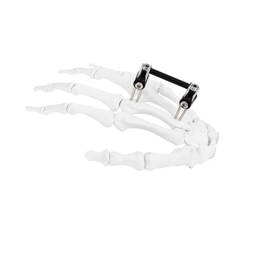 Nẹp Cố Định Xương Bàn Tay Dạng Mini, Dụng Cụ Cố Định Ngoài Dạng Kết Hợp Chỉnh Hình Nẹp Cố Định Xương Bàn Tay Dạng Mini, Dụng Cụ Cố Định Ngoài Dạng Kết Hợp Chỉnh Hình