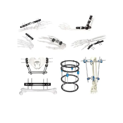 Nẹp Cố Định Xương Bàn Tay Dạng Mini, Dụng Cụ Cố Định Ngoài Dạng Kết Hợp Chỉnh Hình Nẹp Cố Định Xương Bàn Tay Dạng Mini, Dụng Cụ Cố Định Ngoài Dạng Kết Hợp Chỉnh Hình