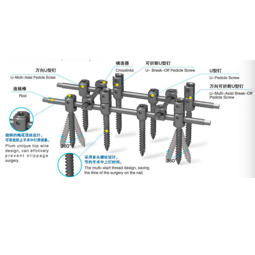 Hệ Thống Vít Đơn Cột Sống 5.5/6.0 Hệ Thống Vít Đơn Cột Sống 5.5/6.0