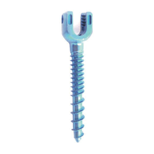 Vít Cuống Sống Đơn Trục UPASS (Hợp kim Titanium) Vít Cuống Sống Đơn Trục UPASS (Hợp kim Titanium)