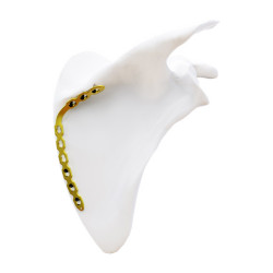 Nẹp khóa xương bả vai (Bờ trong) (A)