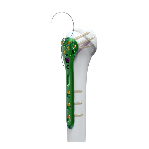 Nẹp khóa đầu trên xương cánh tay-2 đa hướng (TC20) Nẹp khóa đầu trên xương cánh tay-2 đa hướng (TC20)